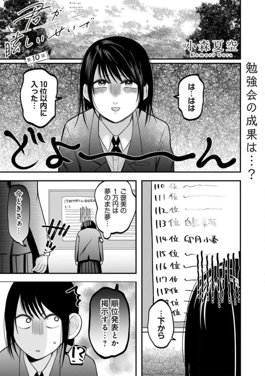 君が眩しいせいで 第10話 - Page 1